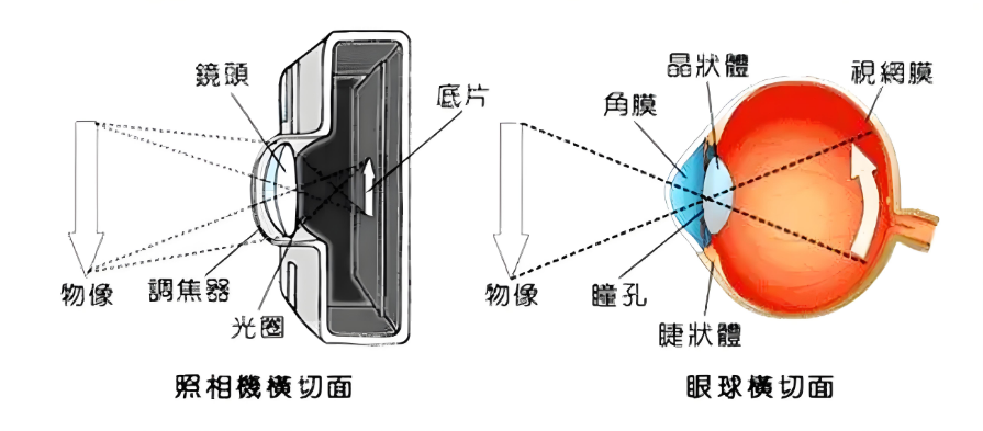 眼底病，常見的眼底病