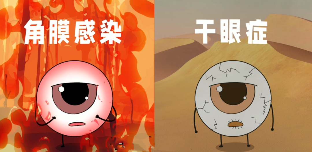 幹眼症,青光眼,眼中風 幹眼症,青光眼,眼中風