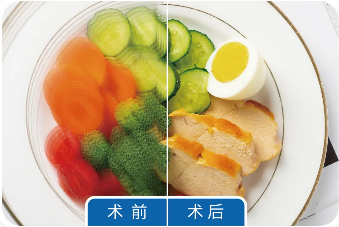 白內障手術,白內障人工晶體怎麼選,深圳希華愛康健醫院 白內障手術,白內障人工晶體怎麼選,深圳希華愛康健醫院